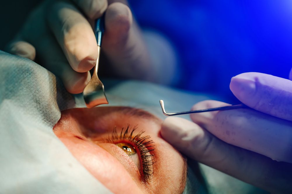 طرق علاج انتفاخ الجفن السفلي للعين بالجراحة